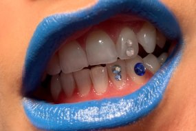 Disco Grillz