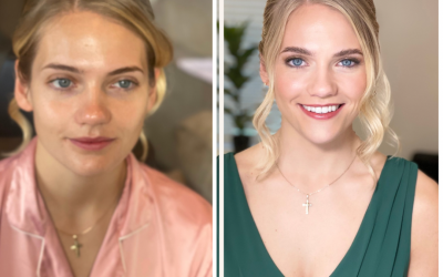before-after-minimal-skincare-instagram-post.png