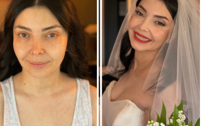 before-after-minimal-skincare-instagram-post.png